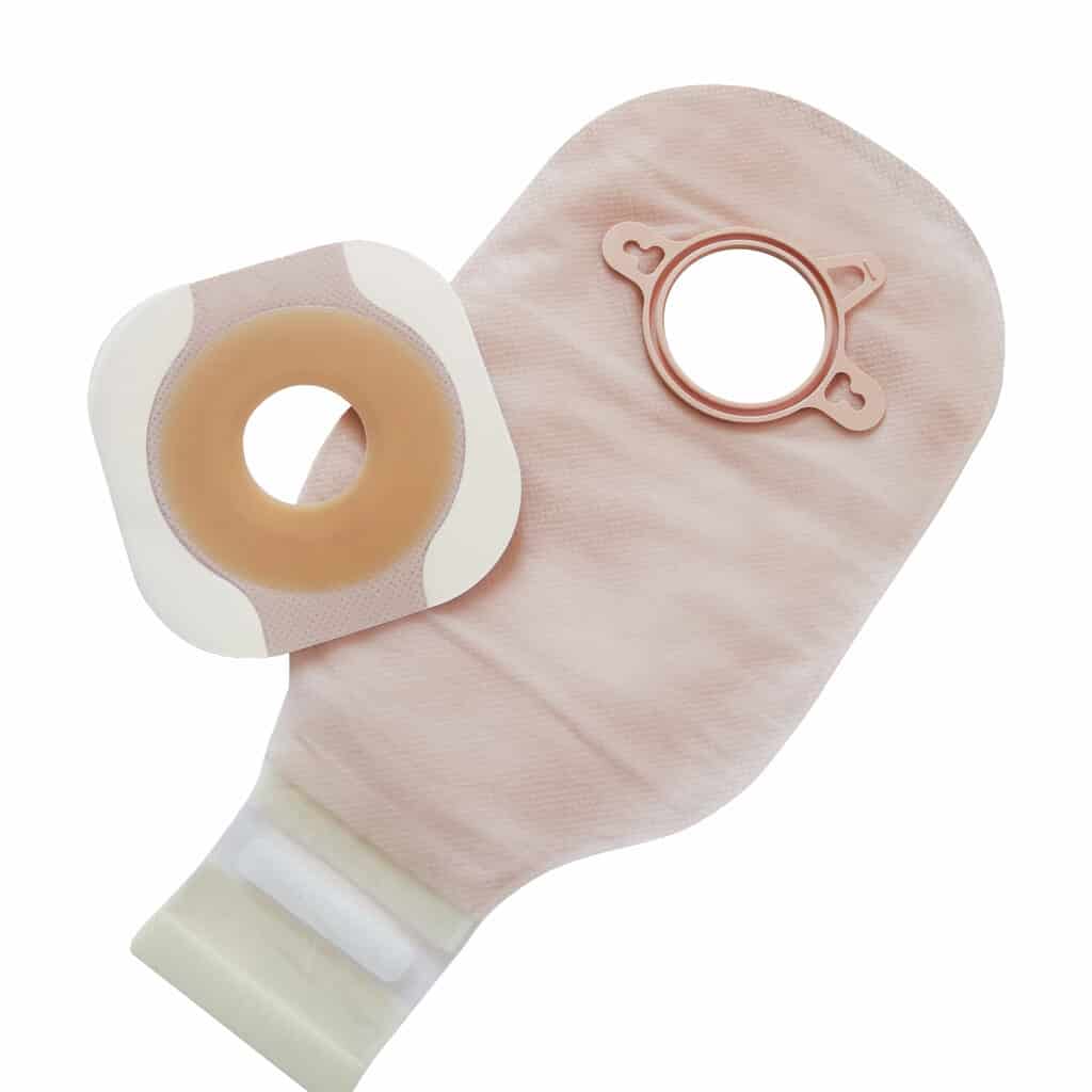 custom ostomy components